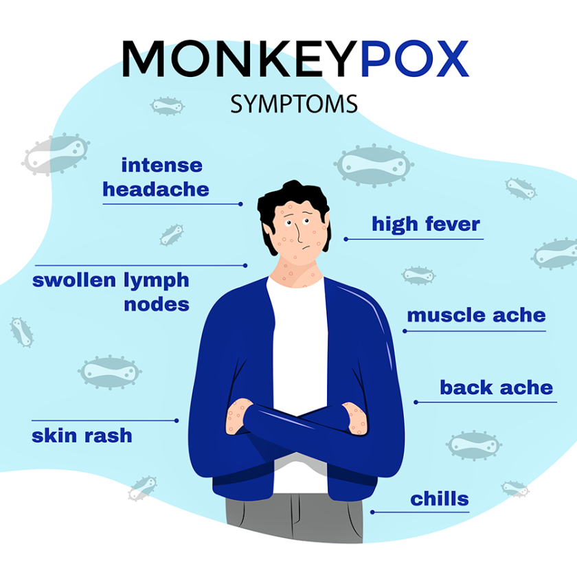 monkeypox symptoms