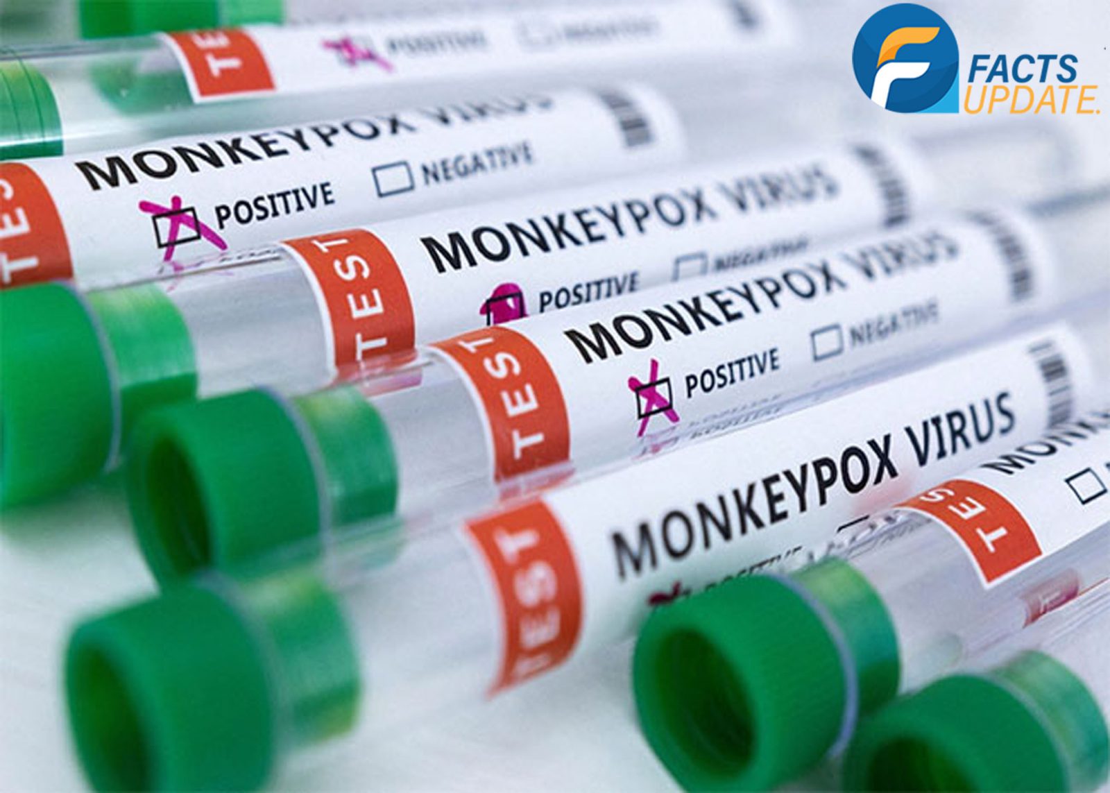 Monkeypox Virus spreading across the Pakistan and whole world
