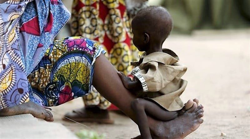 UN says 1.4 million children at imminent risk of death in famines